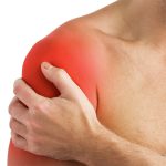 shoulder and arm pain physiotherapy tynemouth