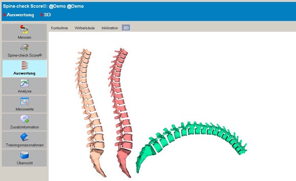 illustrations spinal check