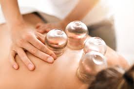 cupping treatment