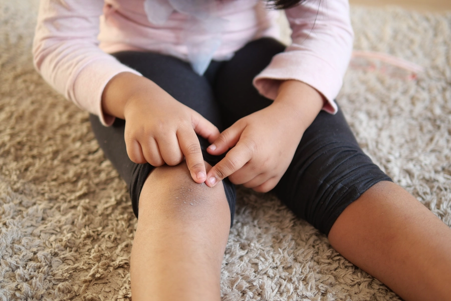 Child Knee Pain 2 1