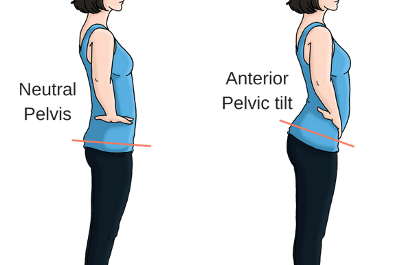 anterior pelvic tilt vs neutral pelvis | Pelvic tilt, Easy yoga poses, Easy  yoga